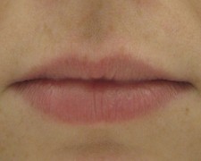 Femme, 26 ans, lèvres Avant