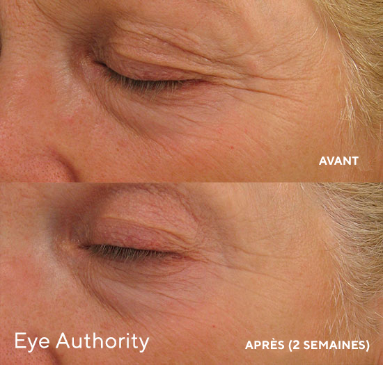 Eye Authority ~ Cernes Yeux gonflés Ridules – Image 4