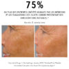 Lumapro-C ~ Correcteur de pigmentation, illuminateur de peau – Image 3
